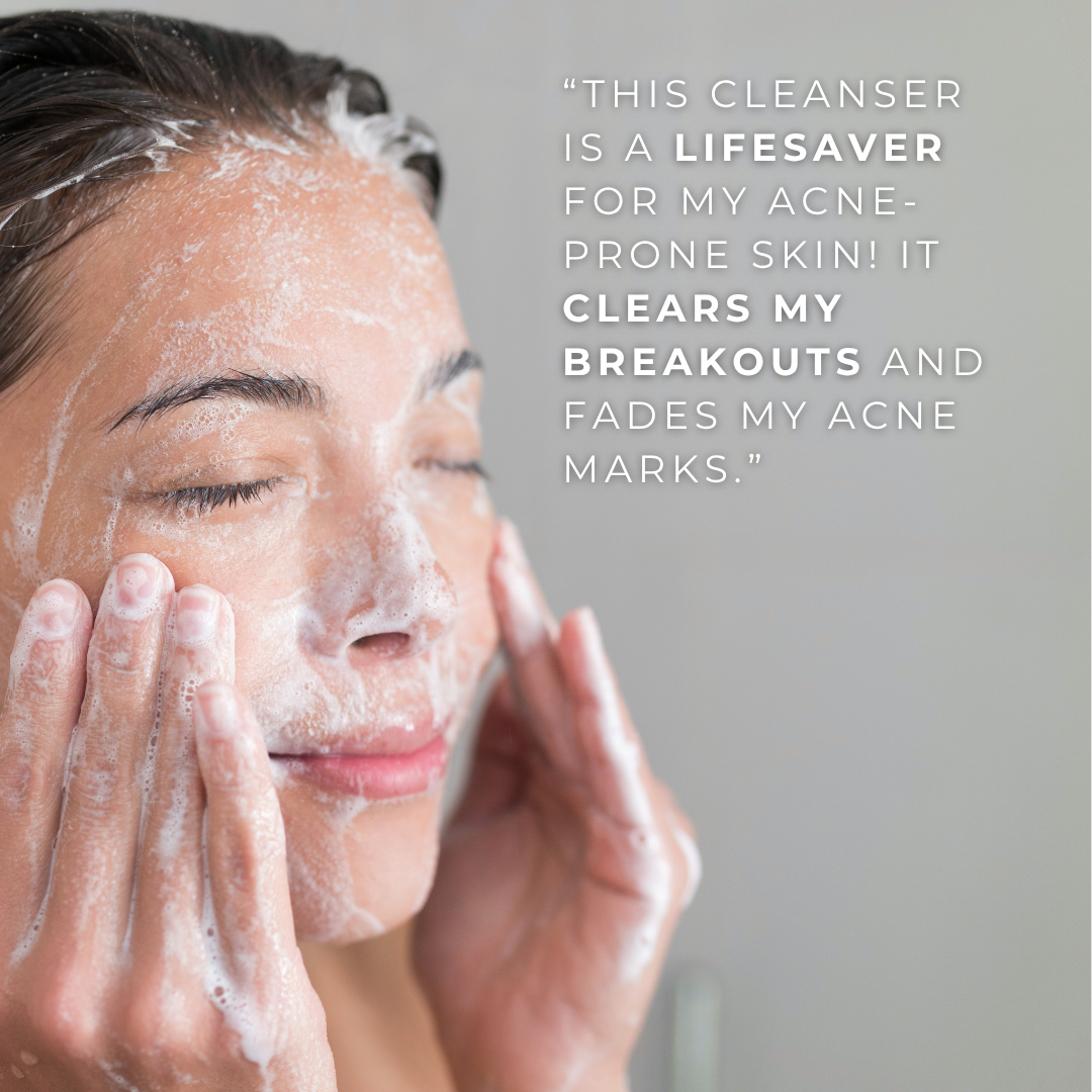 LAMIUX deep cleanser for acne-prone skin with gentle lathering formula for effective breakouts treatment