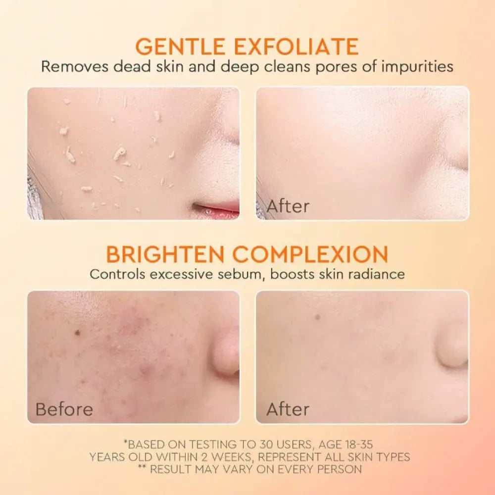GLAD2GLOW APRICOT GLYCOLIC ACID EXFO SMOOTH PEELING GEL 50G