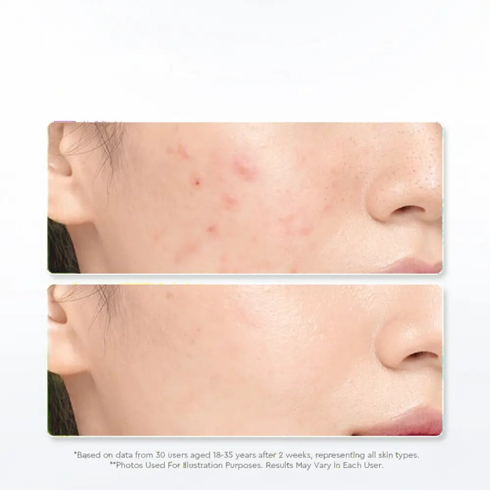 GLAD2GLOW CENTELLA ALLANTOIN SOOTHING GEL MOISTURIZER 100G