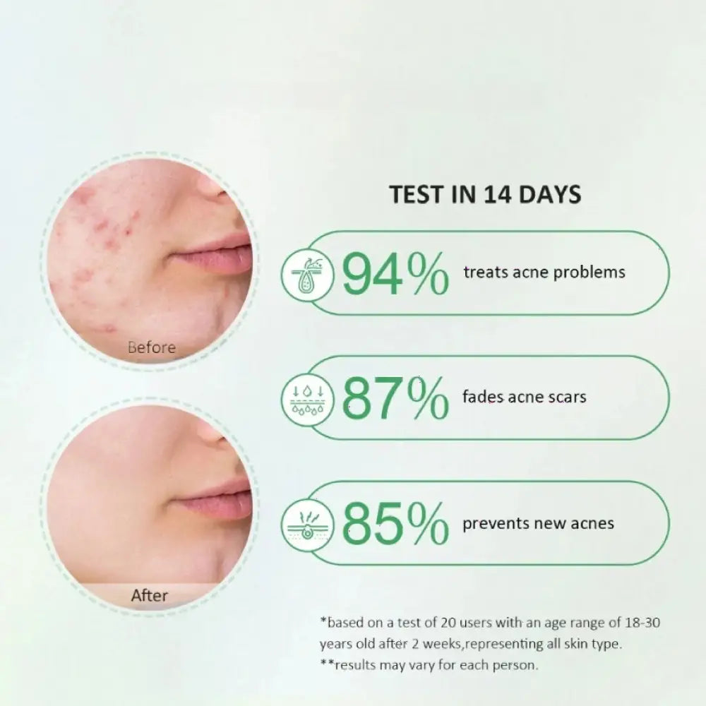 GLAD2GLOW CENTELLA SALICYLIC ACID POWER ACNE SERUM 17ML
