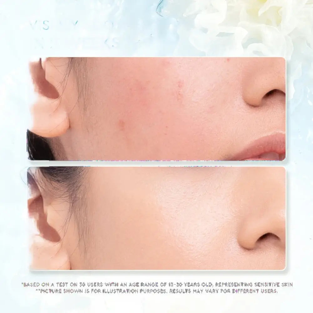 GLAD2GLOW TREMELLA VITA B5 SENSITIVE CALMING MOISTURIZER 30G