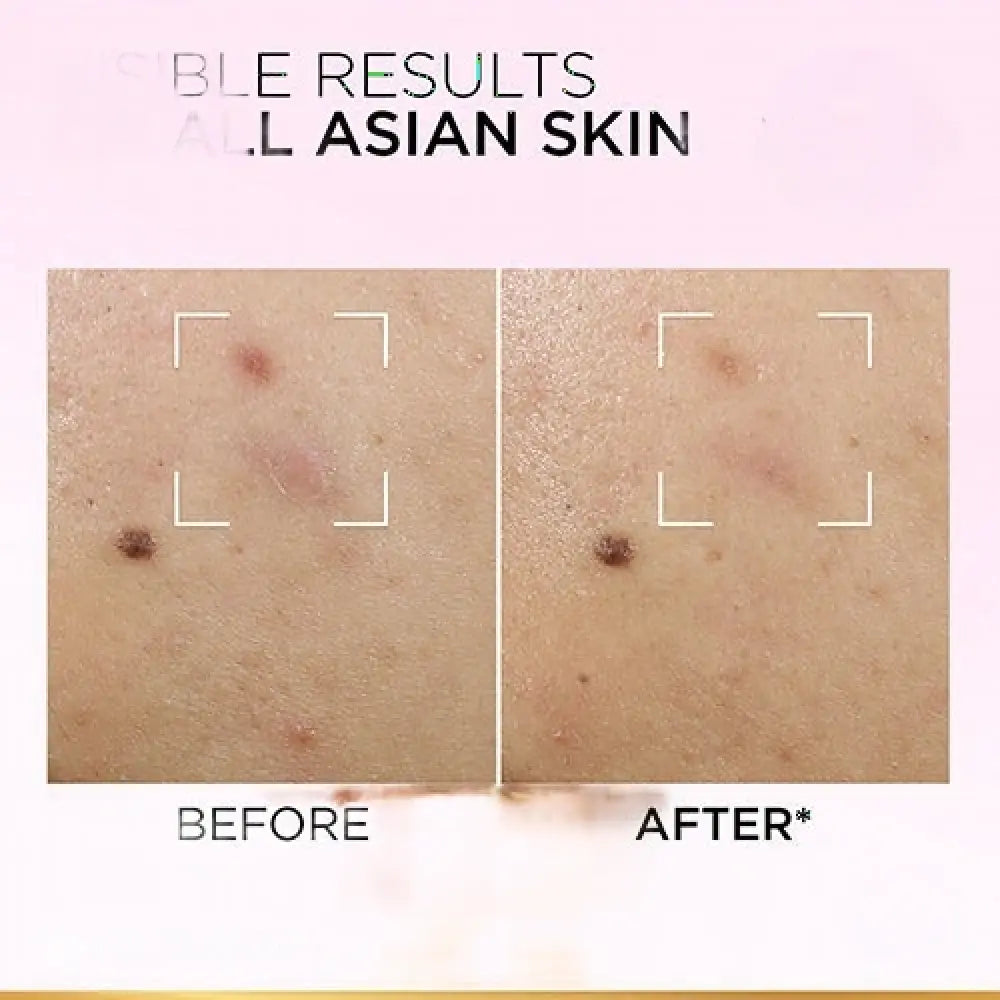 LOREAL GLYCOLIC BRIGHT EXFOLIANT PEEL 25ML